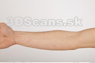 Photo reference of forearm 0001